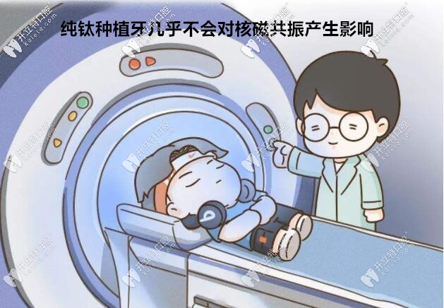 種植牙幾乎不會(huì)對核磁共振產(chǎn)生影響