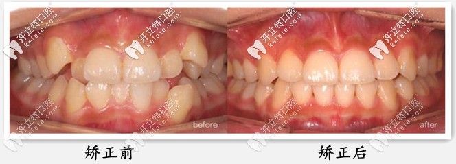 陽(yáng)瓊醫(yī)生復(fù)雜案例圖