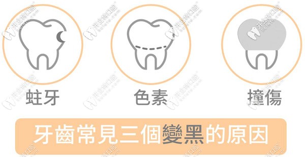 兒童牙齒黑斑是什么原因引起的，需要治療嗎？