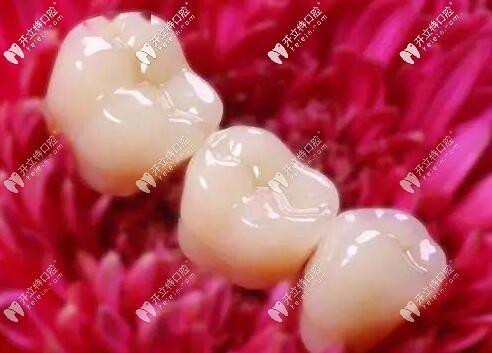 連橋冠修復(fù)