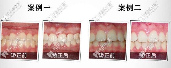 重慶團(tuán)圓私立口腔醫(yī)院到底好不好？是連鎖牙科么？