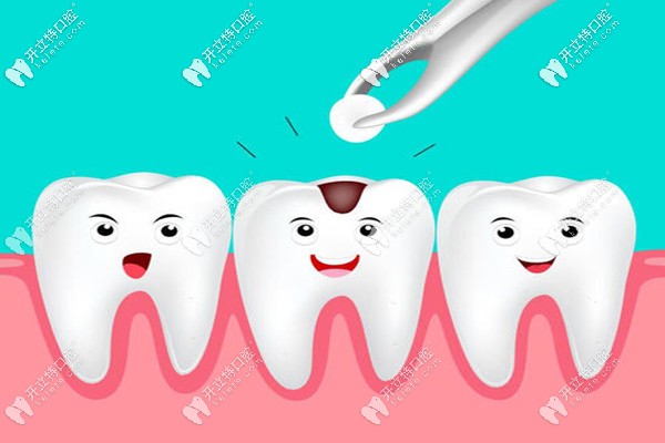 玉林口腔醫(yī)院補(bǔ)牙價(jià)格表