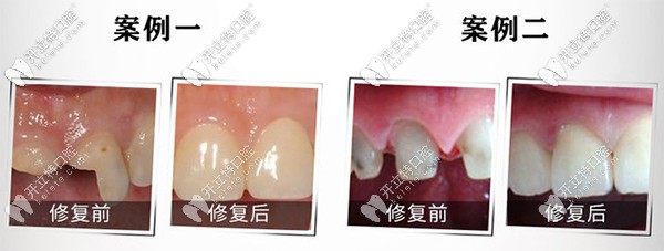 zenostar威蘭德案例