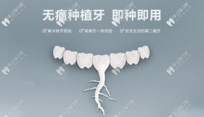 即刻種植牙