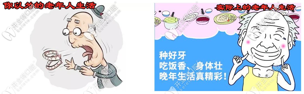 老人掉了很多牙怎么辦？看58歲楊女士的種牙體驗(yàn)
