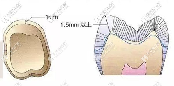 備牙肩臺是什么意思呢