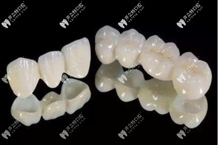 看牙冠制作的過程圖解,你就知道為什么全瓷牙一天做不好了