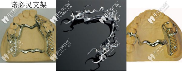 美國(guó)諾必靈支架假牙支架
