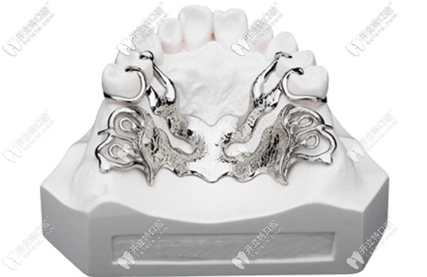 純鈦支架和諾必靈支架哪個(gè)好