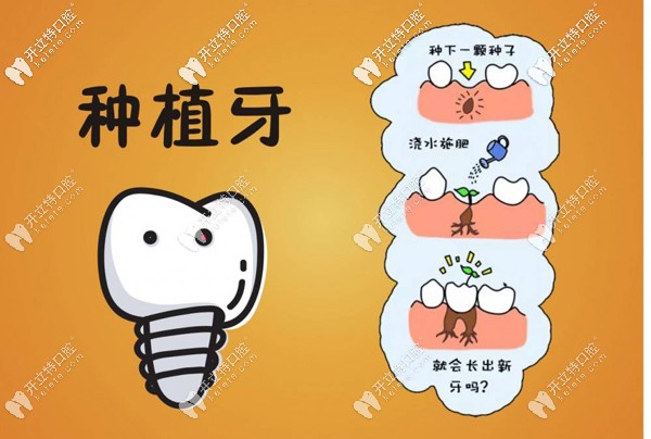 曙光種植牙特惠