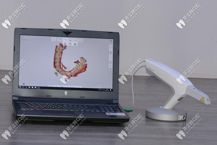 口掃的儀器 口掃的儀器