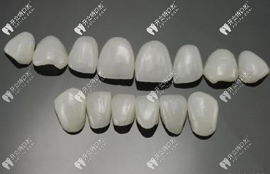 牙齒瓷貼面中的琥珀瓷和藍(lán)瓷貼面區(qū)別大嗎?哪個(gè)好？