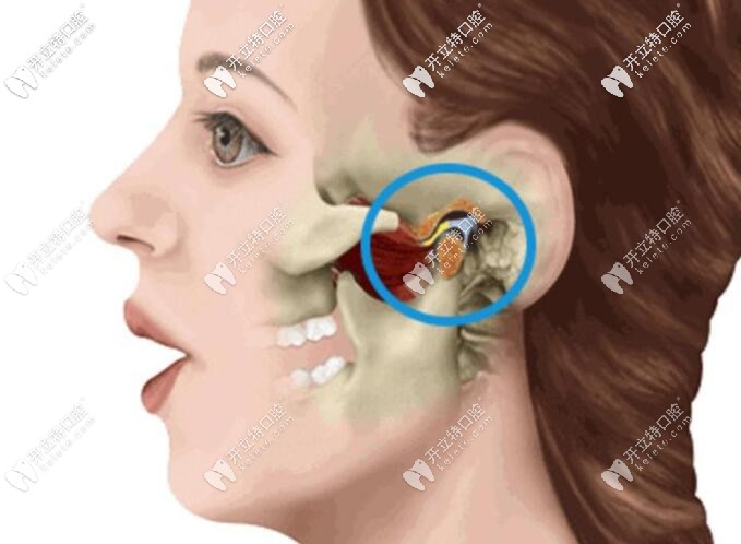 顳下頜關(guān)節(jié)紊亂會彈響 顳下頜關(guān)節(jié)紊亂會彈響