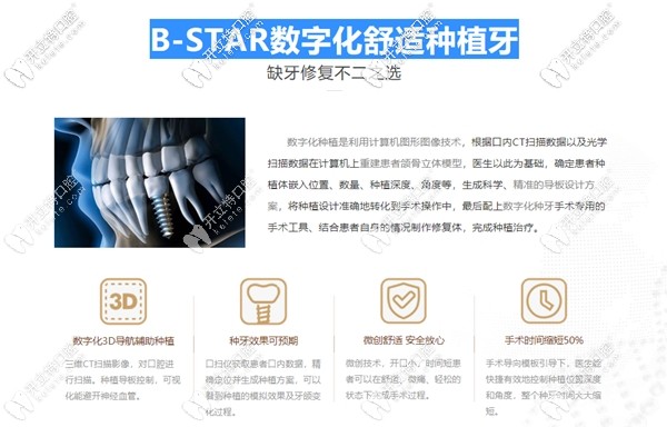 北極星口腔種植牙優(yōu)勢 北極星口腔種植牙優(yōu)勢