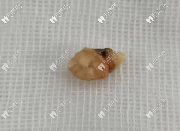 牙齒長(zhǎng)鼻子里的圖片