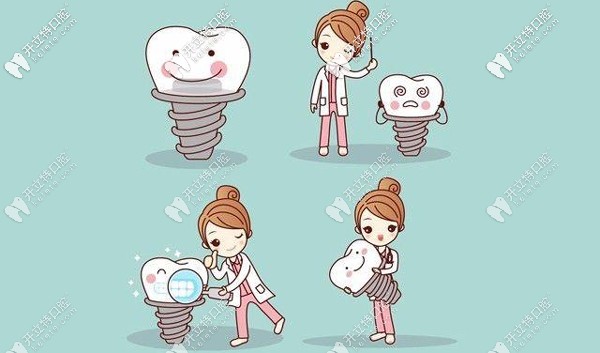 簡析韓國紐百特和登騰種植體哪個好？使用壽命誰更長？