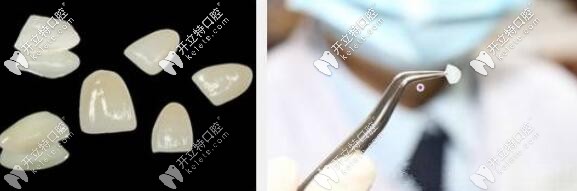 瓷貼面種類大全