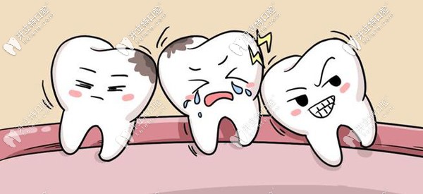 廈門登特口腔拔智齒多少錢？想知道登特和公立醫(yī)院比貴么