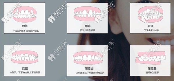 美恒矯正器適應(yīng)癥