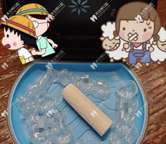 隱適美矯正器 隱適美矯正器