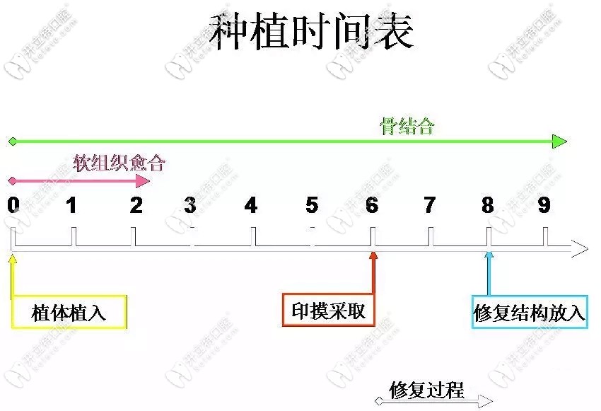 種植牙時(shí)間表