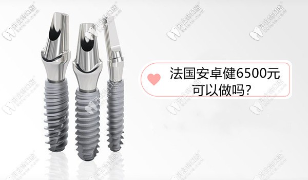 法國安卓健種植牙價格6500元可以做嗎?