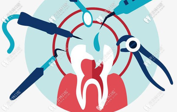 拔牙后多久種牙和牙位也有關