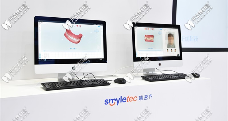 瑞速齊隱形矯正價(jià)格是多少錢？Smyletec是哪個(gè)國(guó)家的？