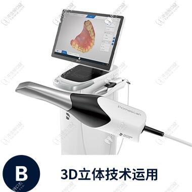  3D 黑科技可視化口掃