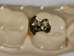 醫(yī)生技術(shù)不豐富，材料填充不嚴(yán)密