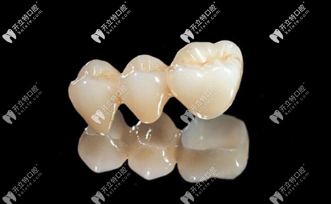 進口氧化鋯全瓷牙