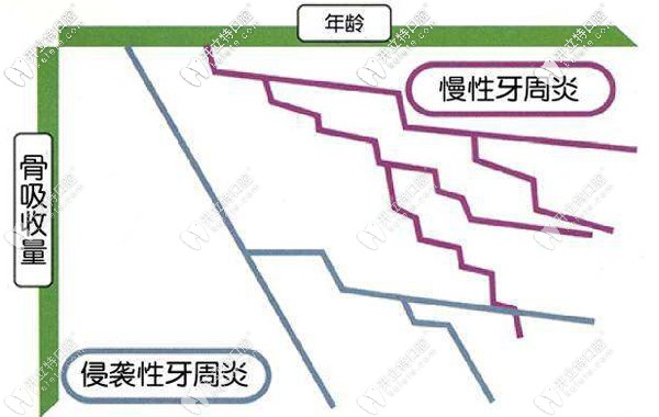 為什么有人會得侵襲性牙周炎