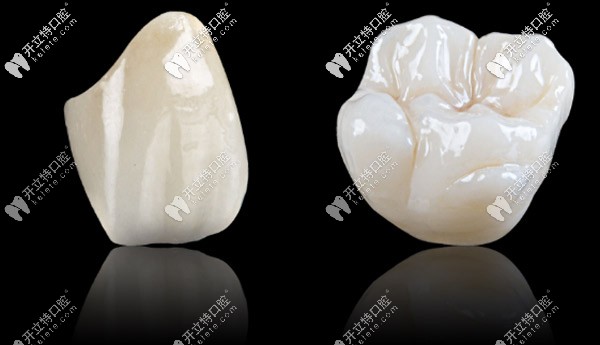 格萊美全瓷牙是進口的嗎，做一顆的價格大概是多少？