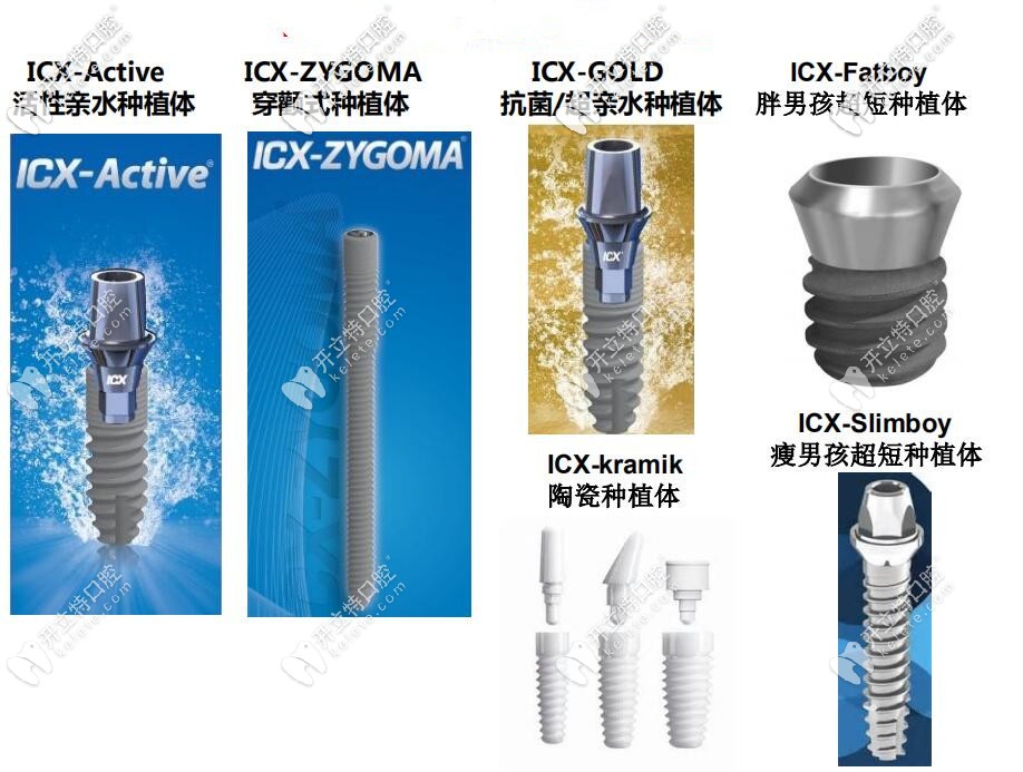 ixc種植體型號表_圖源kelete.com