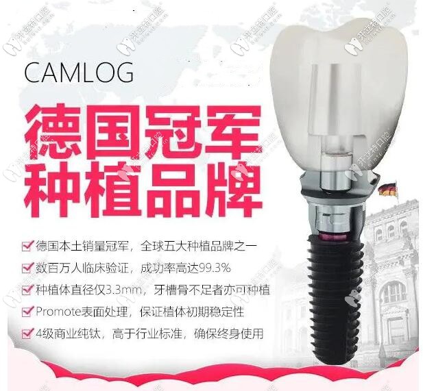 camlog種植體介紹