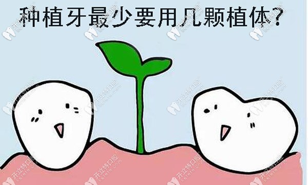 全口種植牙較少要做多少顆？其實(shí)跟種牙方案的選擇有關(guān)