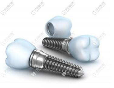 韓國奧齒泰種植牙