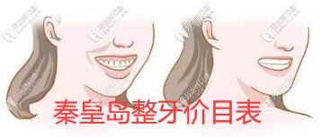 來(lái)一份秦皇島整牙價(jià)目表,看看各口腔醫(yī)院收費(fèi)標(biāo)準(zhǔn)是怎樣的