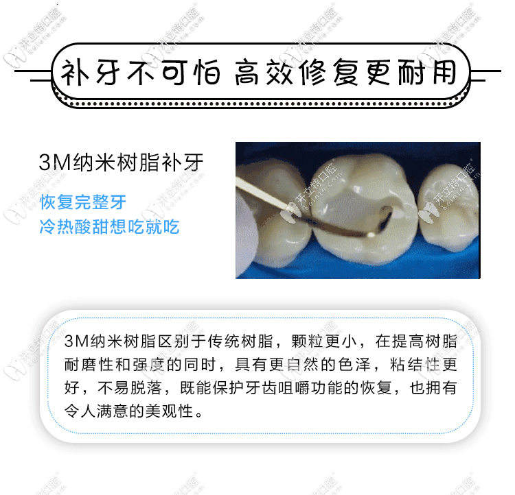 美國3m樹脂補(bǔ)牙