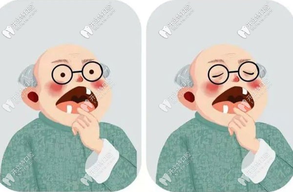 試問(wèn)種植牙咀嚼功能怎么樣,和自己的真牙咀嚼效率一樣嗎？