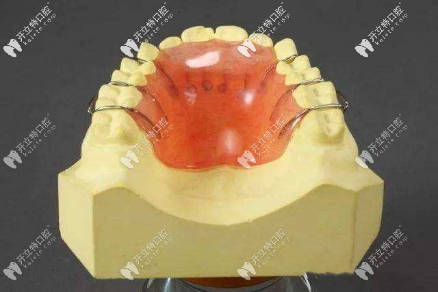 無功能平面牙合墊式上下活動(dòng)矯治器