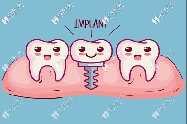邢臺(tái)種植牙一般多少錢(qián)一顆,還想打卡醫(yī)生技術(shù)好的牙科