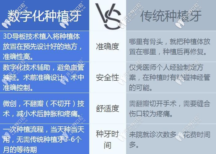 數(shù)字化種植牙和傳統(tǒng)種植牙區(qū)別 數(shù)字化種植牙和傳統(tǒng)種植牙區(qū)別