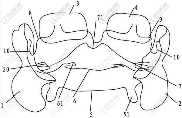 FR—Ⅲ的制作流程圖