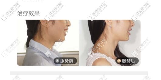 牙齒矯正<span style=