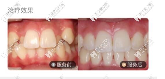牙齒矯正<span style=