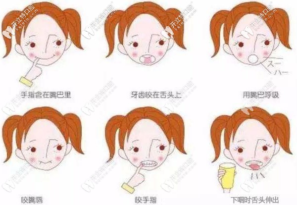 哪些乳牙的情況才適合做早期干預