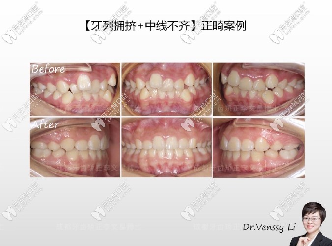 李文星醫(yī)生案例