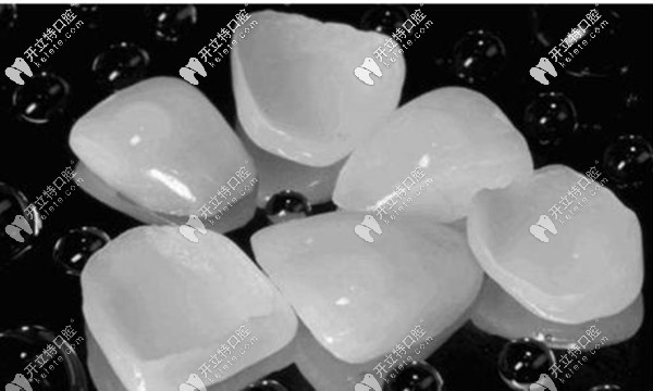 承德可米口腔超薄全瓷貼面