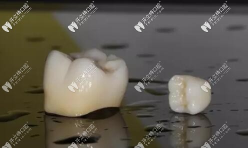 翔通氧化鋯全瓷牙怎么樣?國產(chǎn)親民牙冠本文為你揭曉價格